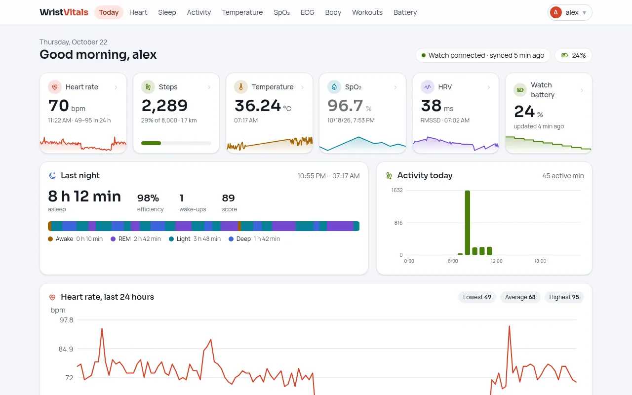 The WristVitals dashboard's Today page: heart rate, steps, temperature, SpO2, HRV and watch battery cards, last night's sleep stages and today's activity, for a fictional person named Alex.